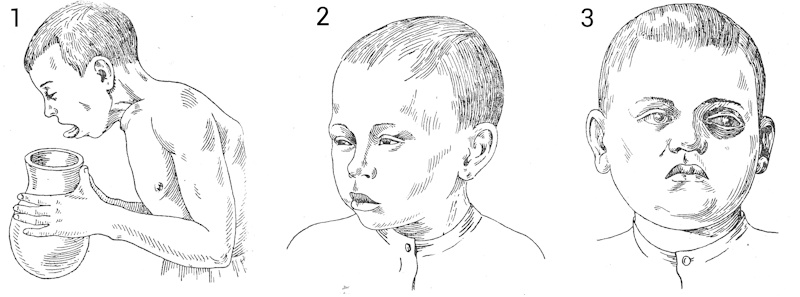 ProDetei